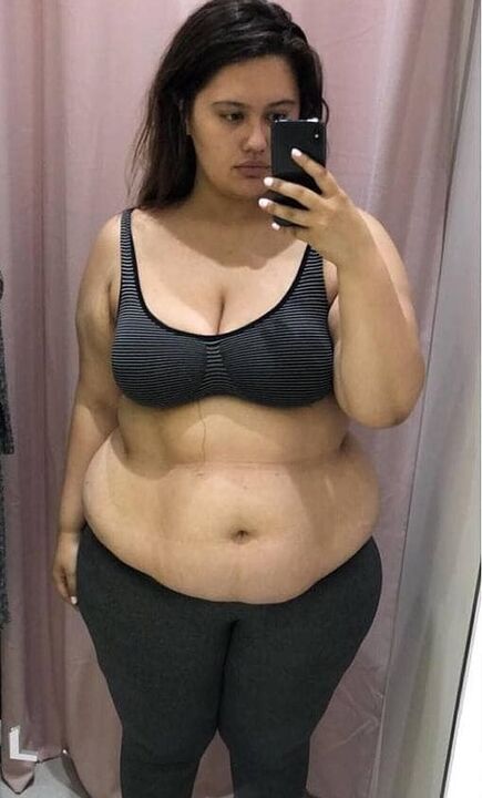 Μισούσα το σώμα μου λόγω των περιττά κιλών.